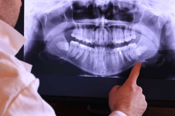 Best Emergency Treatment for Toothache in Newport, AR